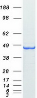 AMACR / P504S Protein - Purified recombinant protein AMACR was analyzed by SDS-PAGE gel and Coomassie Blue Staining