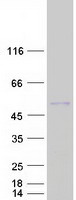 AMBP  Protein - Purified recombinant protein AMBP was analyzed by SDS-PAGE gel and Coomassie Blue Staining