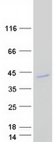 AMD / AMD1 Protein - Purified recombinant protein AMD1 was analyzed by SDS-PAGE gel and Coomassie Blue Staining