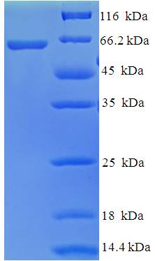 AMDHD1 Protein