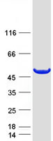 AMDHD1 Protein - Purified recombinant protein AMDHD1 was analyzed by SDS-PAGE gel and Coomassie Blue Staining
