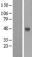 AMDHD2 Protein - Western validation with an anti-DDK antibody * L: Control HEK293 lysate R: Over-expression lysate