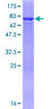 AMDHD2 Protein - 12.5% SDS-PAGE of human AMDHD2 stained with Coomassie Blue