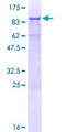 Ameloblastin / AMBN Protein - 12.5% SDS-PAGE of human AMBN stained with Coomassie Blue