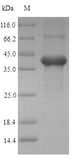 AMELX Protein - (Tris-Glycine gel) Discontinuous SDS-PAGE (reduced) with 5% enrichment gel and 15% separation gel.