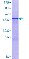 AMELX Protein - 12.5% SDS-PAGE of human AMELX stained with Coomassie Blue