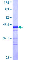 AMELX Protein - 12.5% SDS-PAGE Stained with Coomassie Blue.