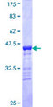 AMELX Protein - 12.5% SDS-PAGE Stained with Coomassie Blue.