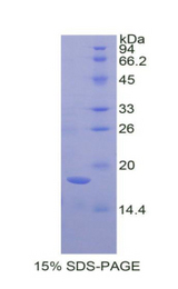 AMELX Protein - Recombinant Amelogenin, X-Linked By SDS-PAGE
