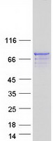AMER2 Protein - Purified recombinant protein AMER2 was analyzed by SDS-PAGE gel and Coomassie Blue Staining