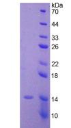 AMH / Anti-Mullerian Hormone Protein - Recombinant Anti-Mullerian Hormone By SDS-PAGE