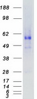 AMHR2 / MISRII Protein - Purified recombinant protein AMHR2 was analyzed by SDS-PAGE gel and Coomassie Blue Staining