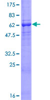 AMICA / JAML Protein - 12.5% SDS-PAGE of human AMICA1 stained with Coomassie Blue