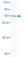 AMID / AIFM2 Protein - 12.5% SDS-PAGE Stained with Coomassie Blue.