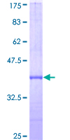 AMID / AIFM2 Protein - 12.5% SDS-PAGE Stained with Coomassie Blue.