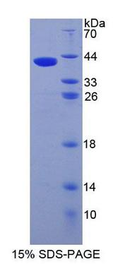AMIGO Protein - Recombinant Adhesion Molecule With Ig Like Domain Protein 1 By SDS-PAGE