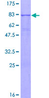 AMIGO3 Protein - 12.5% SDS-PAGE of human AMIGO3 stained with Coomassie Blue