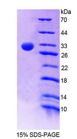 AML1 / RUNX1 Protein - Recombinant Runt Related Transcription Factor 1 (RUNX1) by SDS-PAGE