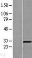 AMMECR1 Protein - Western validation with an anti-DDK antibody * L: Control HEK293 lysate R: Over-expression lysate