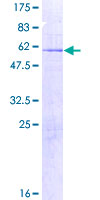 AMMECR1 Protein - 12.5% SDS-PAGE of human AMMECR1 stained with Coomassie Blue