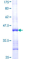 AMMECR1 Protein - 12.5% SDS-PAGE Stained with Coomassie Blue.