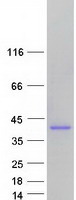 AMMECR1 Protein - Purified recombinant protein AMMECR1 was analyzed by SDS-PAGE gel and Coomassie Blue Staining