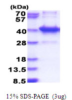 AMMECR1L Protein