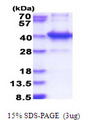 AMMECR1L Protein