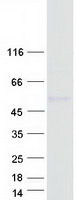 AMN Protein - Purified recombinant protein AMN was analyzed by SDS-PAGE gel and Coomassie Blue Staining