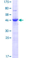 AMN1 Protein - 12.5% SDS-PAGE of human AMN1 stained with Coomassie Blue