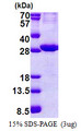 AMOG / ATP1B2 Protein