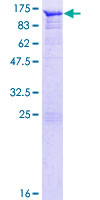 AMOT / Angiomotin Protein - 12.5% SDS-PAGE of human AMOT stained with Coomassie Blue