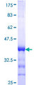 AMOT / Angiomotin Protein - 12.5% SDS-PAGE Stained with Coomassie Blue.