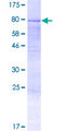 AMOTL2 Protein - 12.5% SDS-PAGE of human AMOTL2 stained with Coomassie Blue