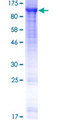 AMPD1 Protein - 12.5% SDS-PAGE of human AMPD1 stained with Coomassie Blue