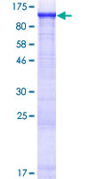 AMPD2 Protein - 12.5% SDS-PAGE of human AMPD2 stained with Coomassie Blue