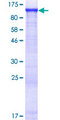 AMPD2 Protein - 12.5% SDS-PAGE of human AMPD2 stained with Coomassie Blue