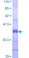 AMPD2 Protein - 12.5% SDS-PAGE Stained with Coomassie Blue.