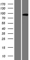 AMPD3 Protein - Western validation with an anti-DDK antibody * L: Control HEK293 lysate R: Over-expression lysate