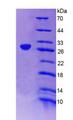AMPH / Amphiphysin Protein - Recombinant Amphiphysin By SDS-PAGE