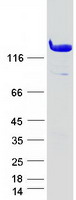 AMPH / Amphiphysin Protein - Purified recombinant protein AMPH was analyzed by SDS-PAGE gel and Coomassie Blue Staining