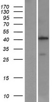 AMT Protein - Western validation with an anti-DDK antibody * L: Control HEK293 lysate R: Over-expression lysate