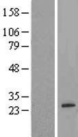 AMTN Protein - Western validation with an anti-DDK antibody * L: Control HEK293 lysate R: Over-expression lysate