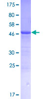 AMTN Protein - 12.5% SDS-PAGE of human AMTN stained with Coomassie Blue