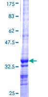 AMY1A / Salivary Amylase Protein - 12.5% SDS-PAGE Stained with Coomassie Blue.
