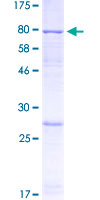 AMY1B Protein - 12.5% SDS-PAGE of human AMY1B stained with Coomassie Blue