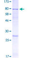 AMY1B Protein - 12.5% SDS-PAGE of human AMY1B stained with Coomassie Blue