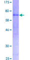 AMY2A / Pancreatic Amylase Protein - 12.5% SDS-PAGE of human AMY2A stained with Coomassie Blue