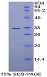 AMY2A / Pancreatic Amylase Protein - Recombinant Amylase Alpha 2, Pancreatic By SDS-PAGE
