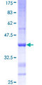 AMY2B Protein - 12.5% SDS-PAGE Stained with Coomassie Blue.